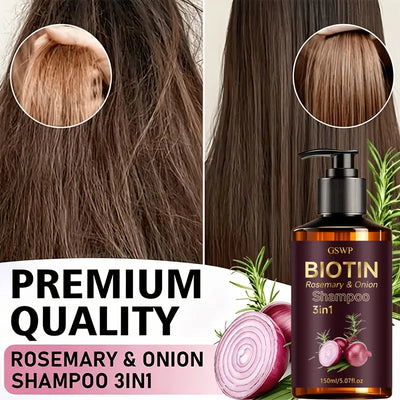 GSWP 3in1 Biotin Rosemary & Onion Shampoo. Deeply Cleanses Scalp, Controls Excess Oil, Moisturizes, Softens and Nourishes. 150ml